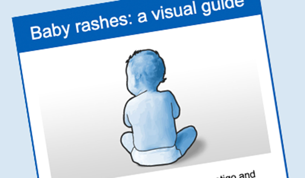 BABY RASHES GUIDE